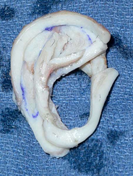 Ear Reconstruction Framework